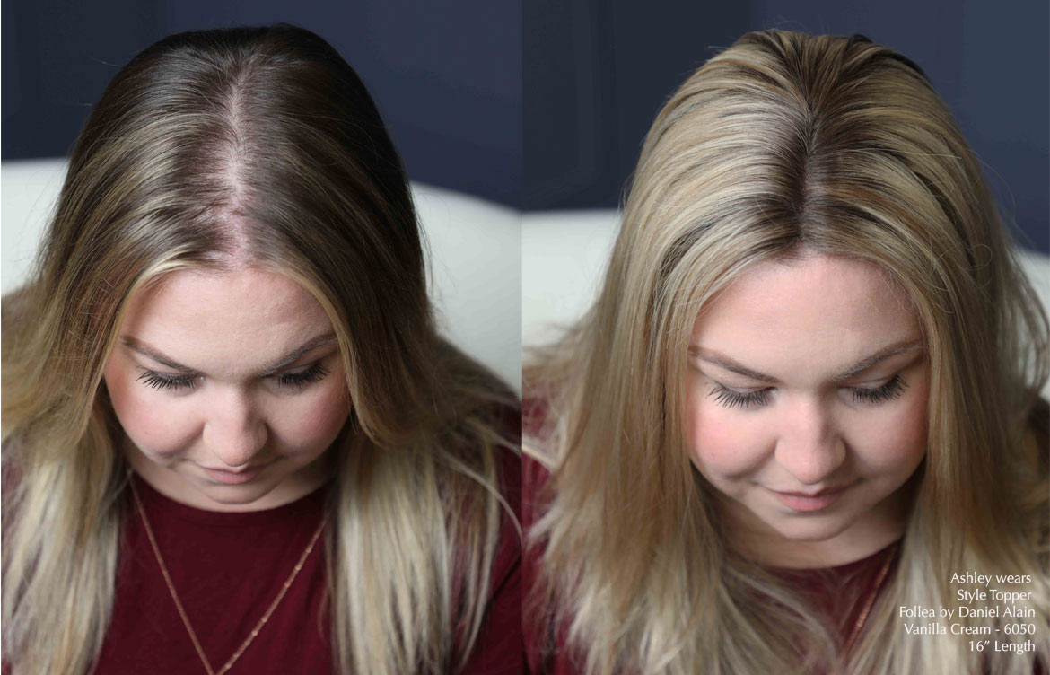 Ashley-before-and-after-topper-with-text-1