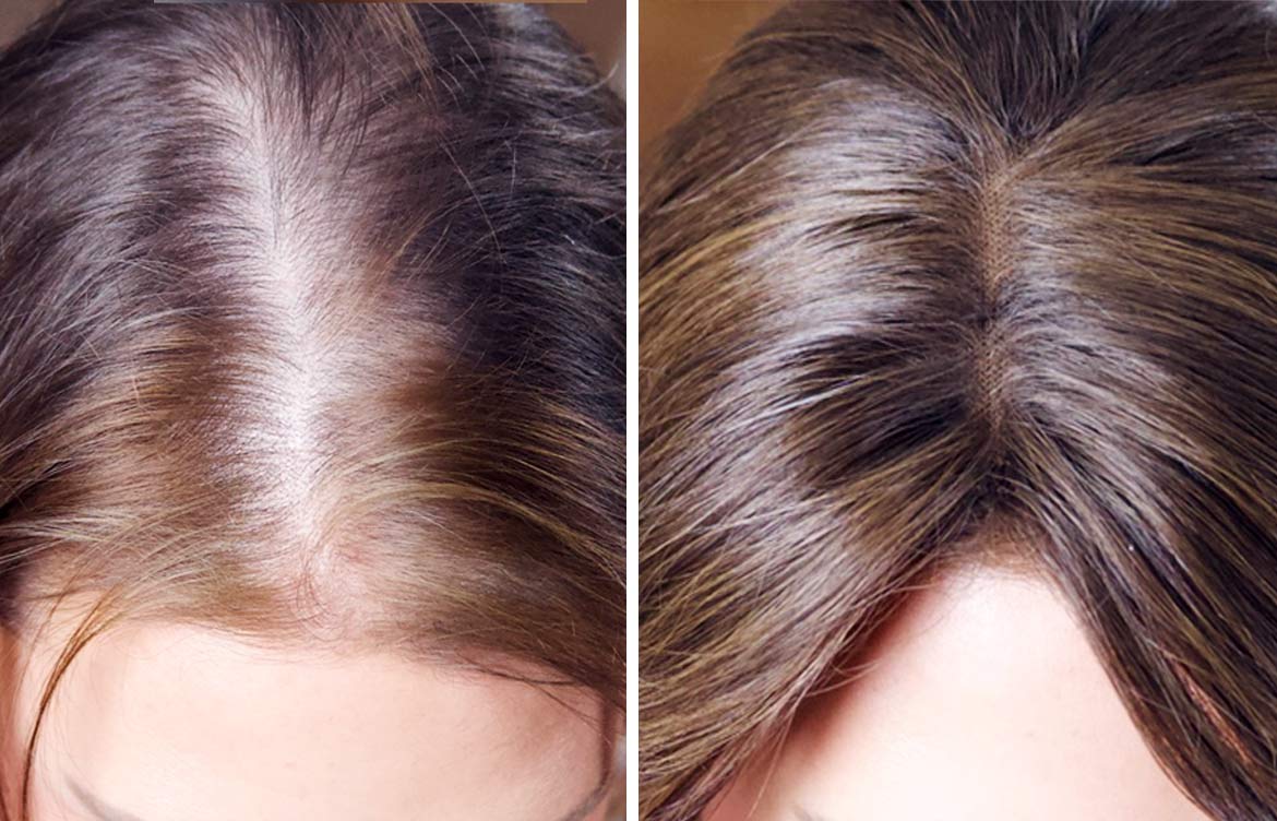 Emily-before-and-after-topper-1