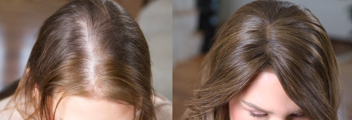 Emily-before-and-after-topper