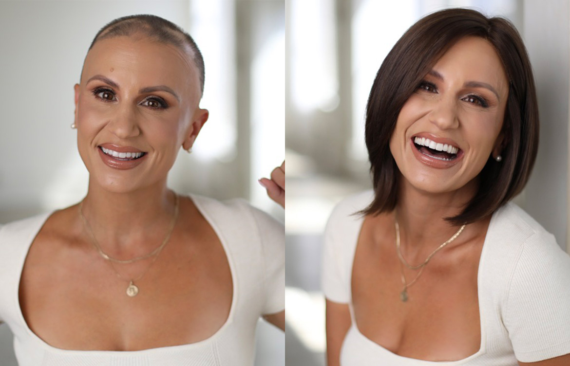 Mirna-before-after