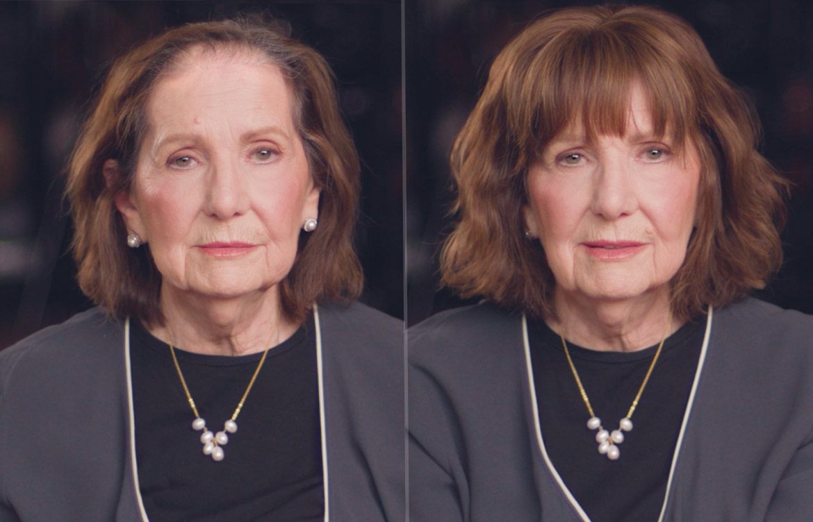 Pat-before-after-1