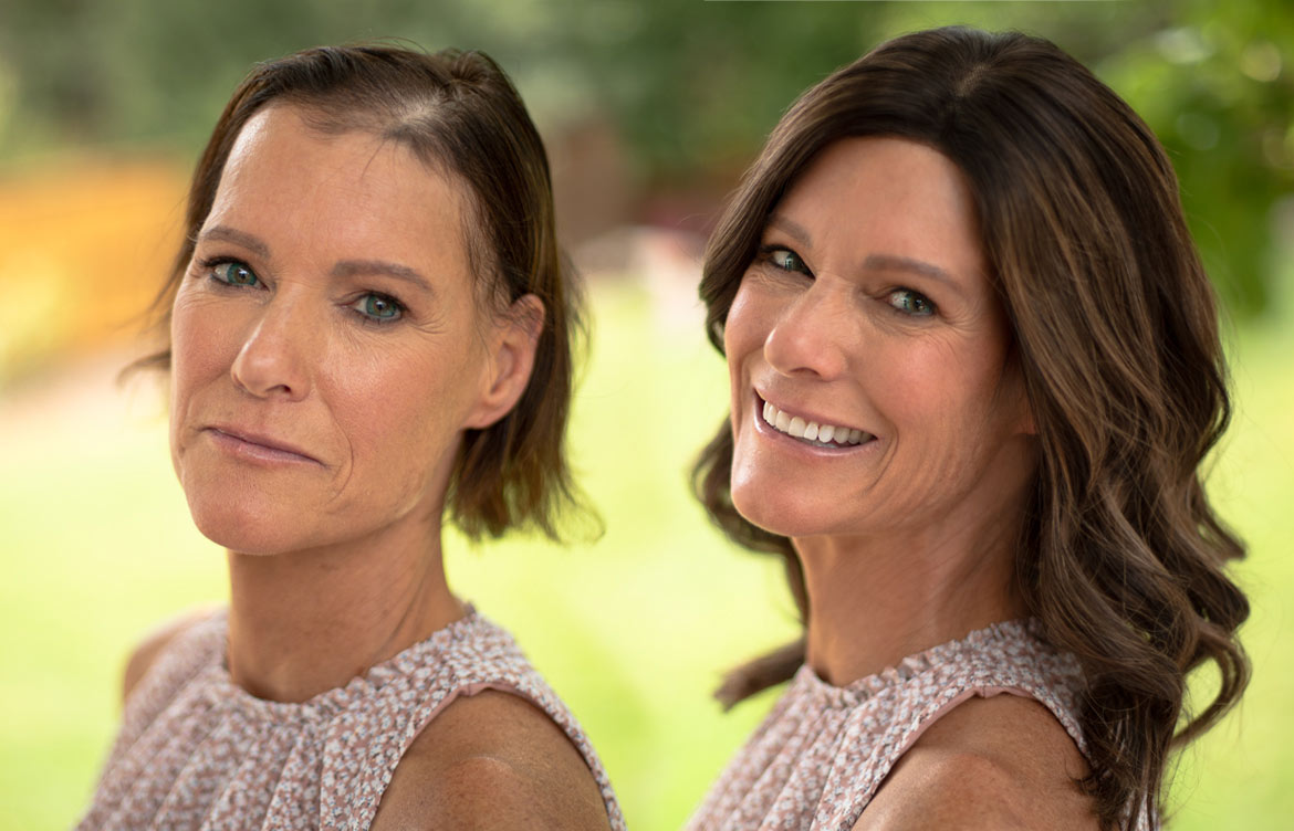 Sally-before---after-Gripper