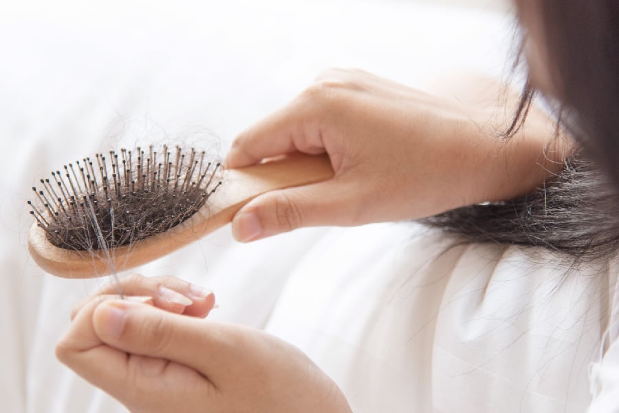 alopecia-hair-loss