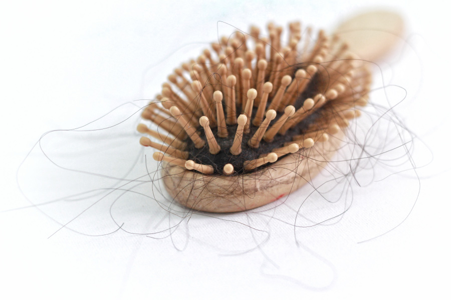 covid-hair-loss-treatment-2