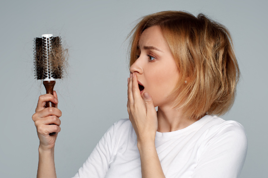 covid-hair-thinning