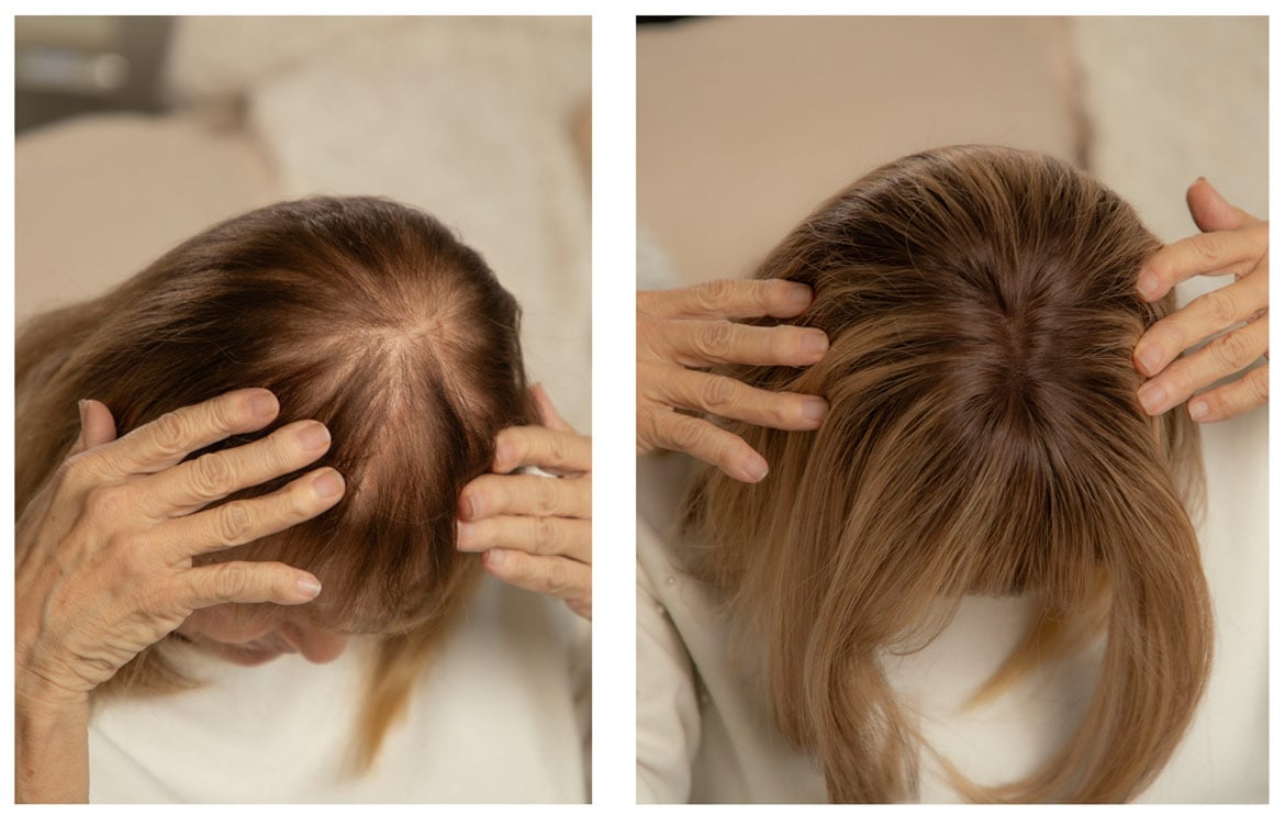 sara-before-after-1